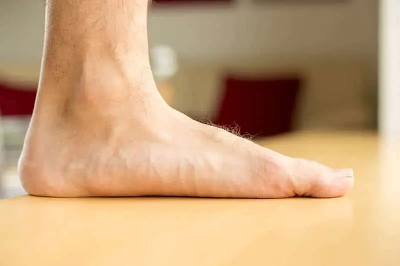 Flat Feet Pain Treatment