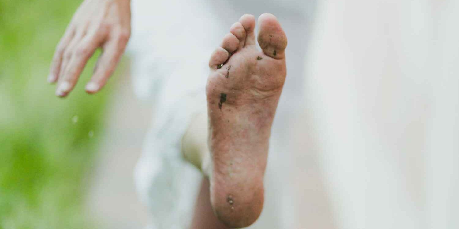 Managing Diabetic Foot Complications Managing Diabetic Foot Complications