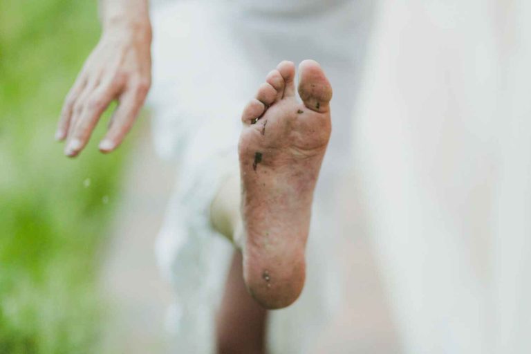 Managing Diabetic Foot Complications