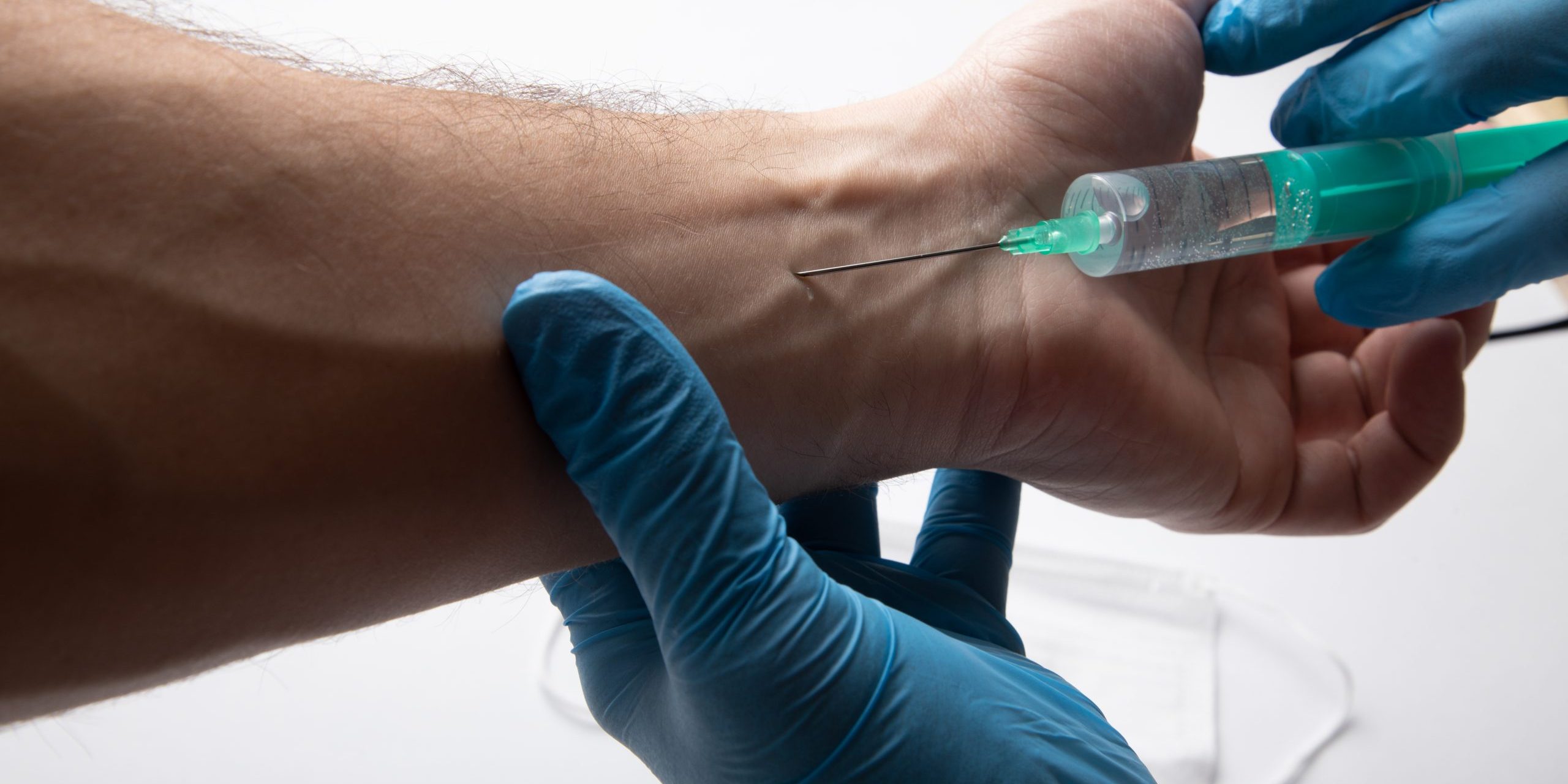 Treats Varicose Veins Treats Varicose Veins