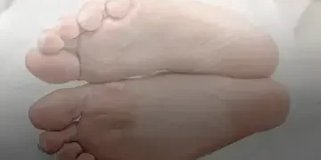 Advancements in Diabetic Foot Care