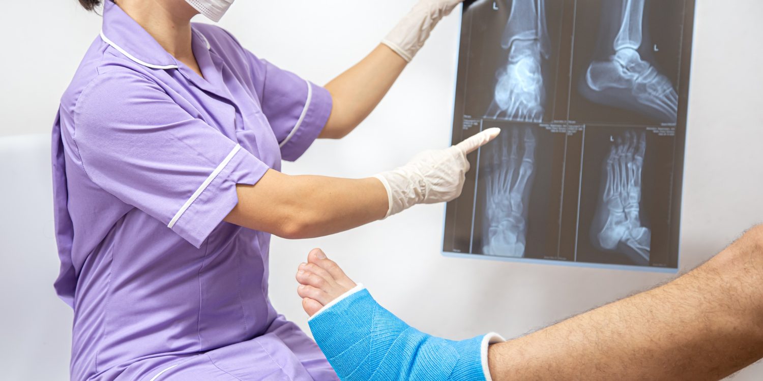 Ankle Replacement Surgery Ankle Replacement Surgery