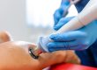 Laser Therapy Can Improve Wound Healing and Reduce Scarring