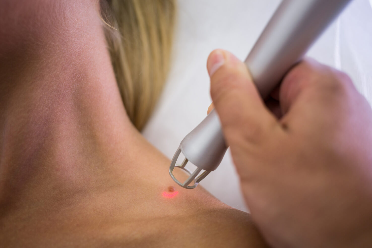 What Types of Wounds and Scars Can Benefit from Laser Therapy