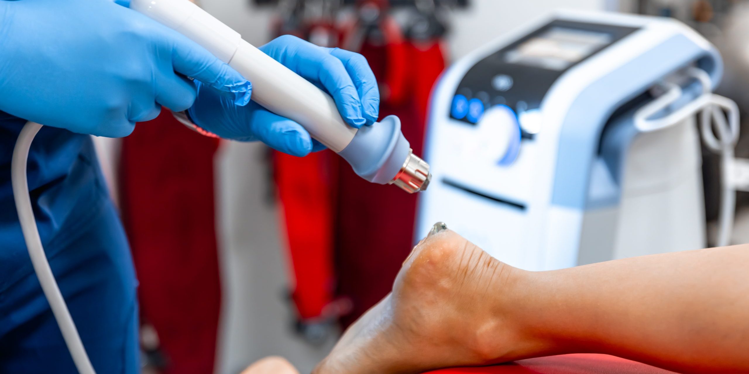 Physical therapy of foot with acoustic shock waves, close up. MLS Laser Therapy Relieves Foot and Ankle Pain