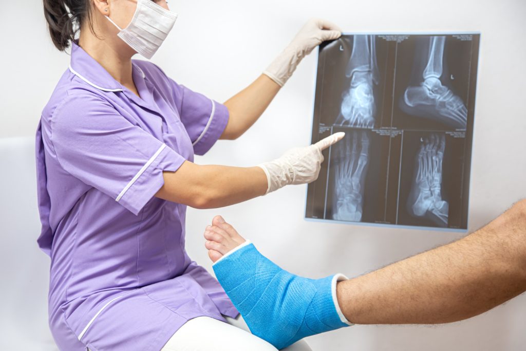 During, and After Bunion Surgery in Jupiter