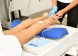 Laser Vein Therapy Treats Varicose Veins