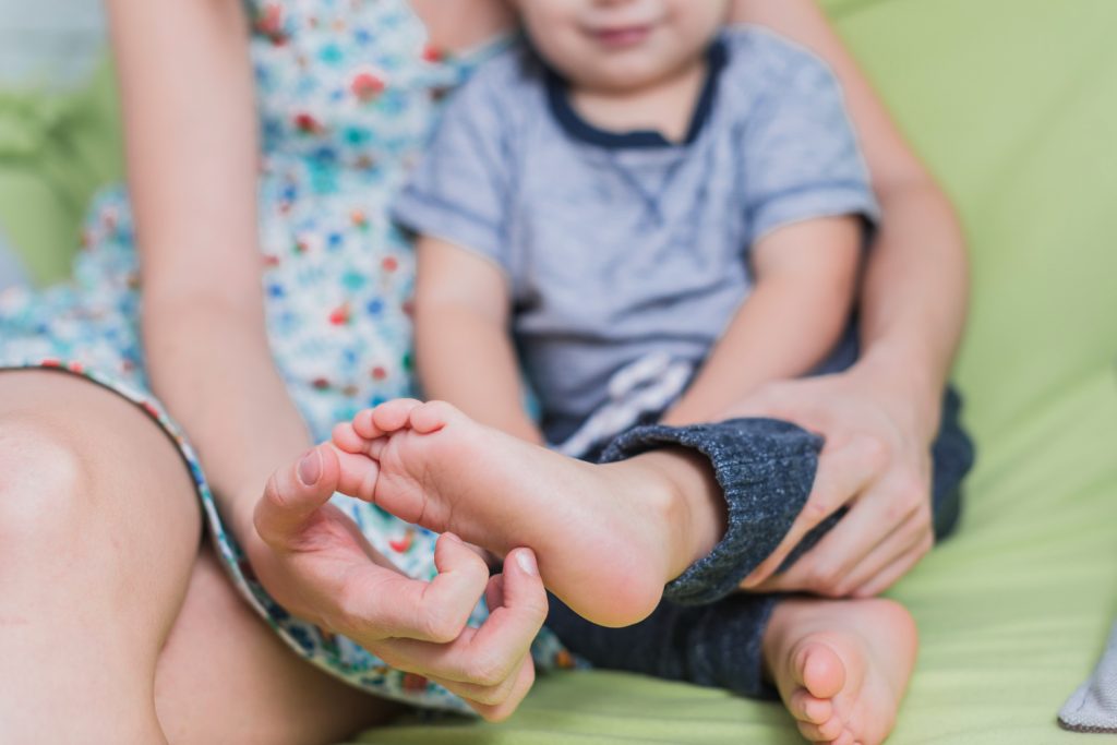 symptoms of Flat Feet in Children