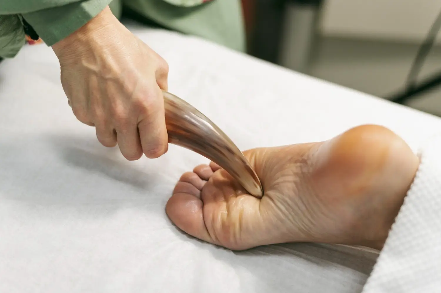 When is Plantar Fasciitis Surgery Considered