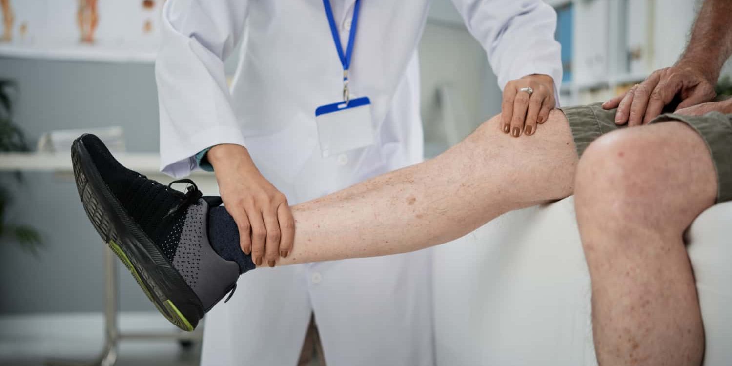 Spider Vein Treatment Before and After What to Expect Spider Vein Treatment Before and After What to Expect