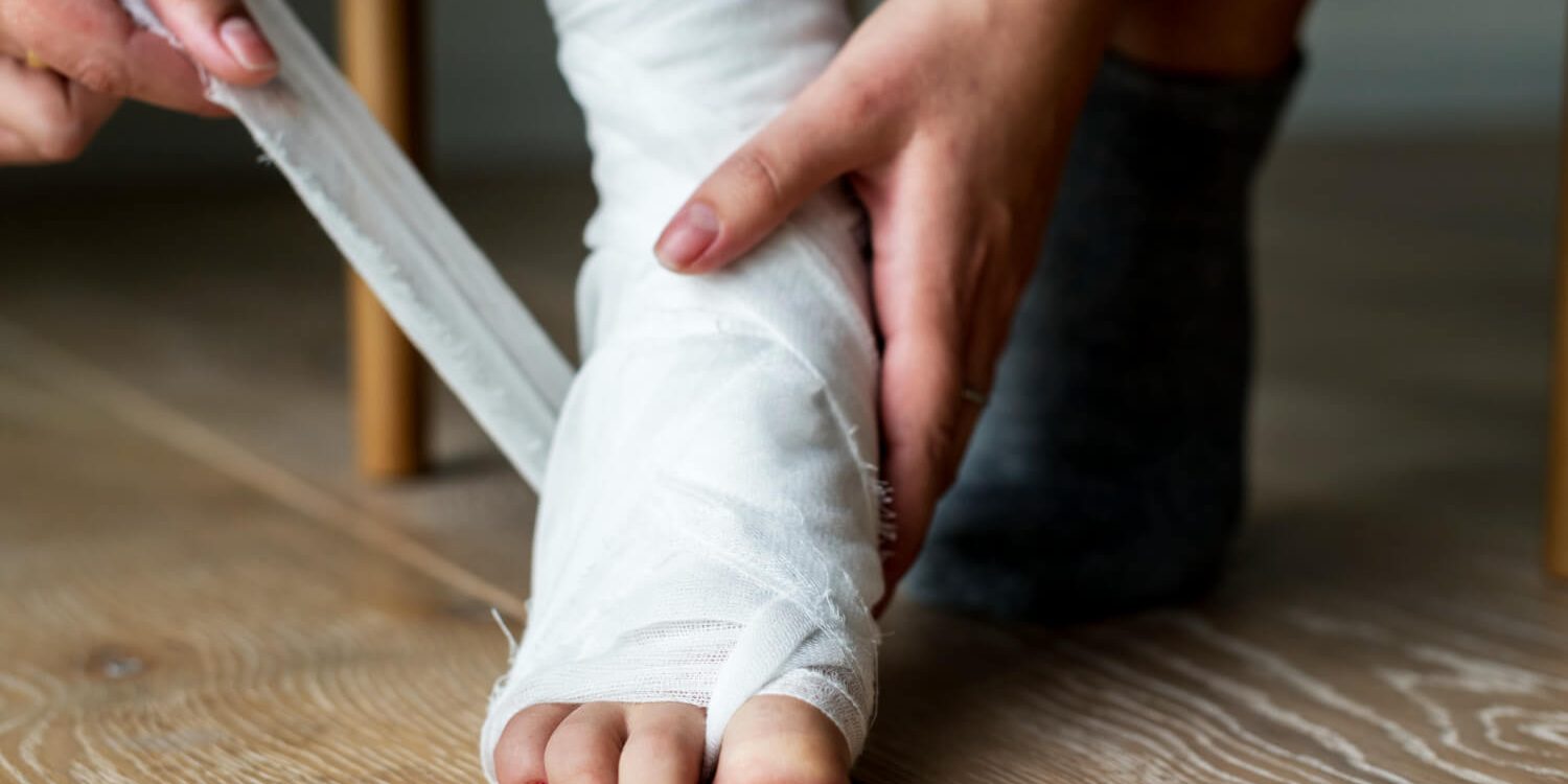 High Ankle Injury Symptoms What to Watch for Early