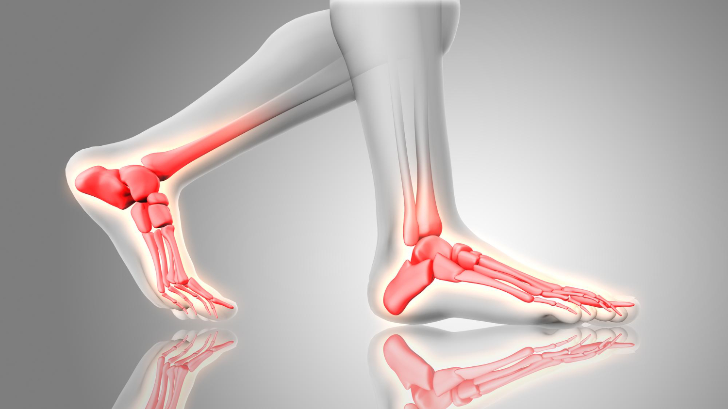 Plantar fat pad atrophy anatomy